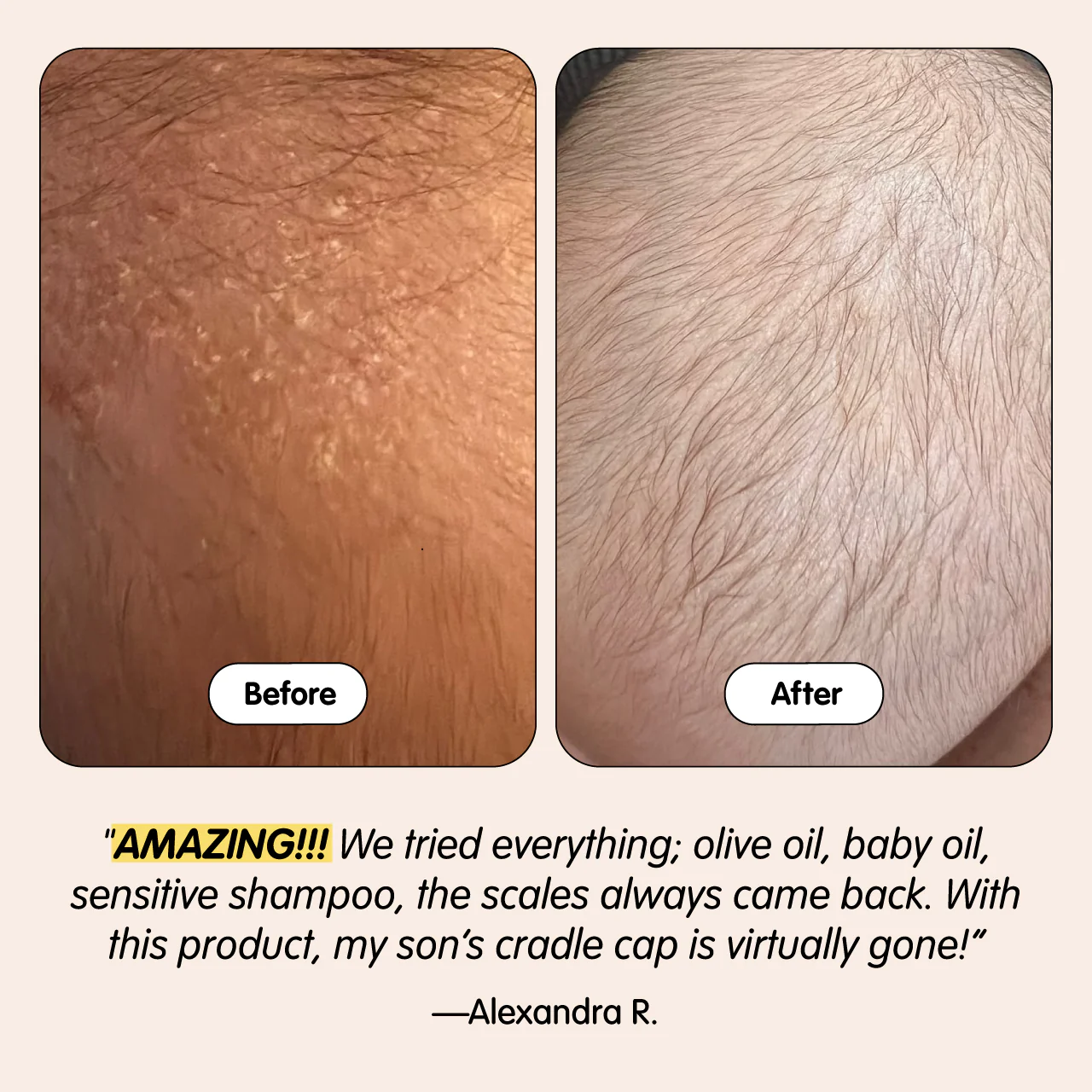 Bye-Bye Cradle Cap - Image 9